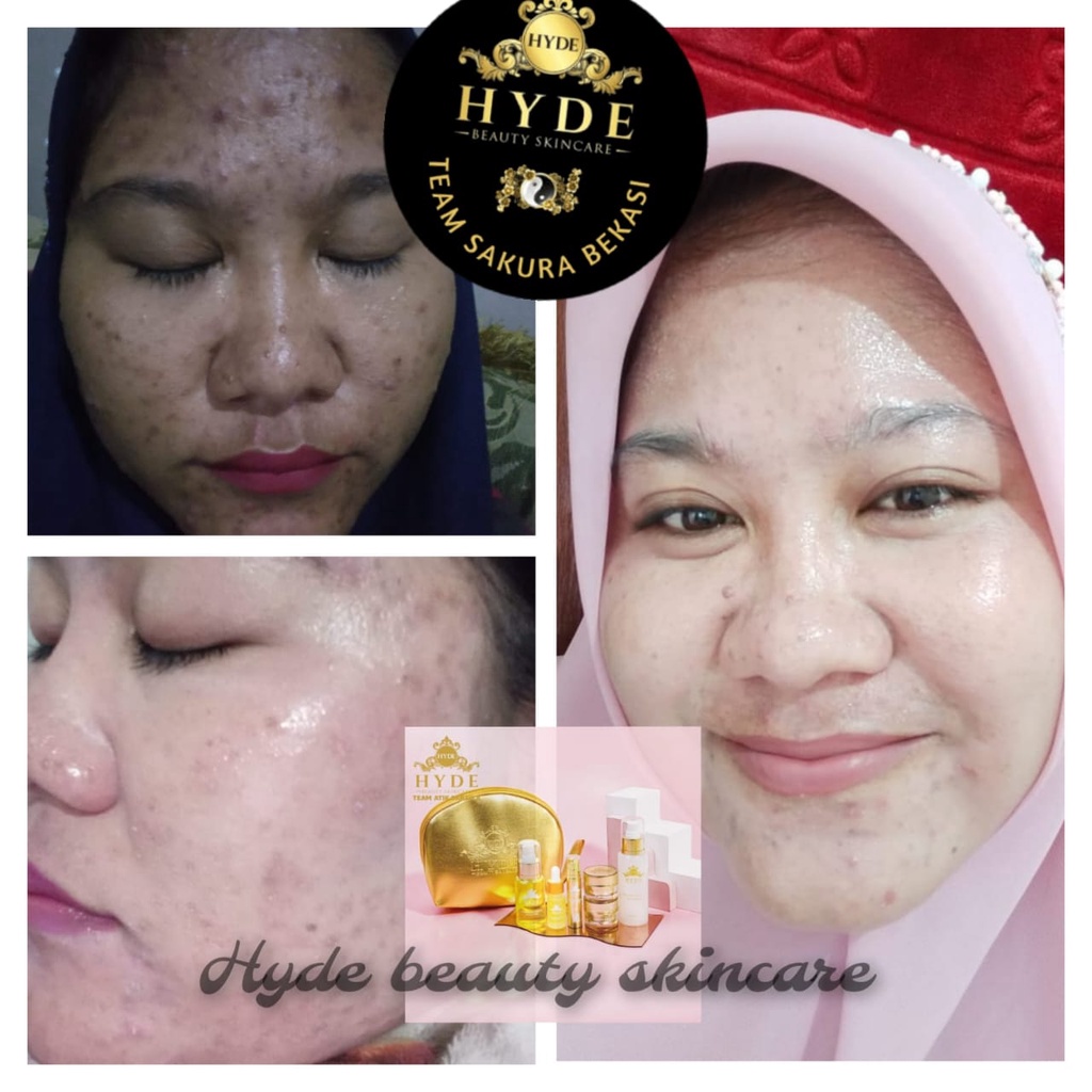 Hyde Beauty Skincare Paket Glowing Isi 4 Serum