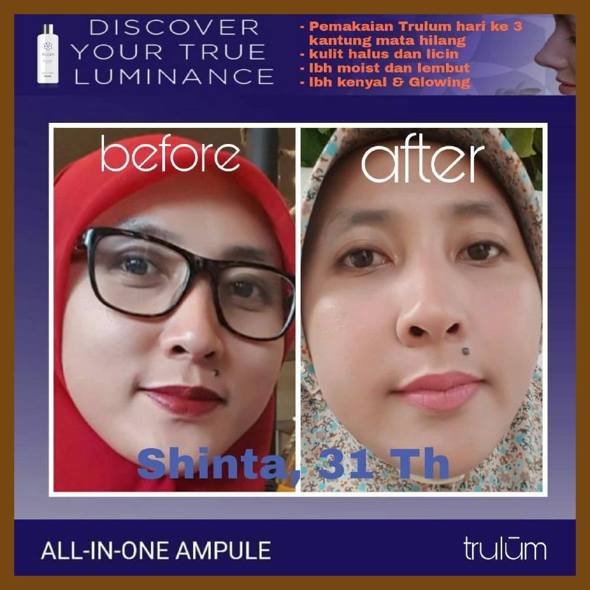 Krim Penghilang Keriput Wajah | Trulum Penghilang Kerutan Wajah Ampuh