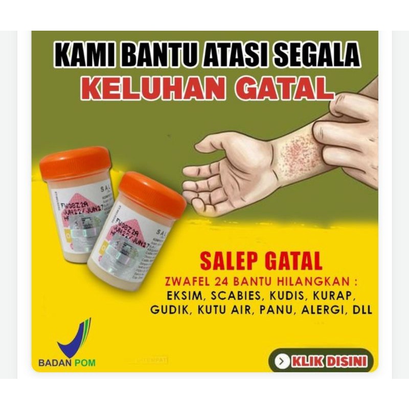 Obat 𝗦𝗔𝗟𝗘𝗣 𝗭𝗪𝗔𝗙𝗘𝗟 𝗜𝗧𝗖𝗛𝗬  𝟮𝟰 𝟮𝟯𝟰 Belerang Sulfur 100% Original BPOM Salep Gatal Kutu Air Eksim Panu Kurap Biduran Gudik Scabies Psoriasis Kutil Mata ikan Jamur Ampuh