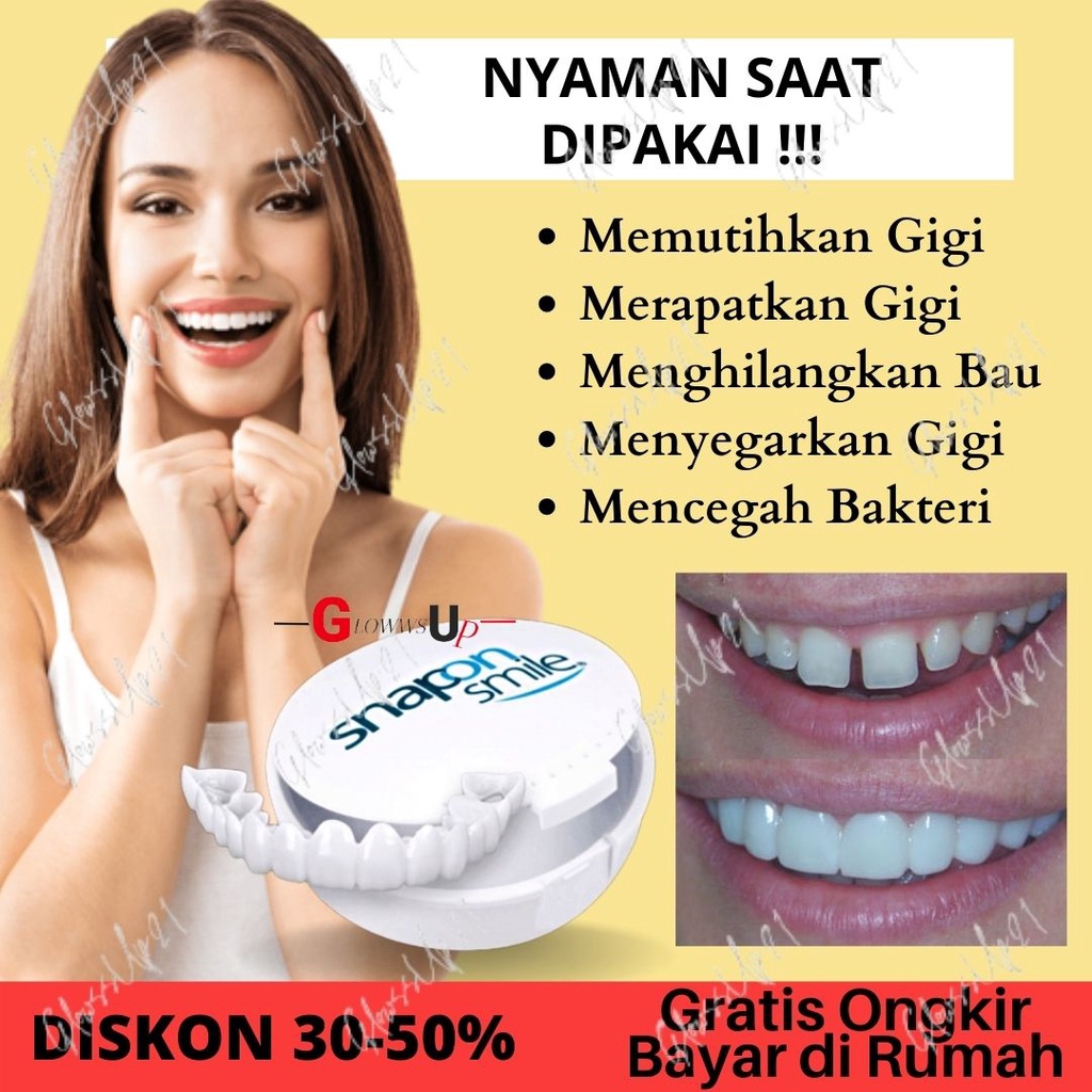 Snap On Smile 100% ORIGINAL Authentic Perawatan Kesehatan Gigi Palsu Renggang Snapon Smile 1 Set
