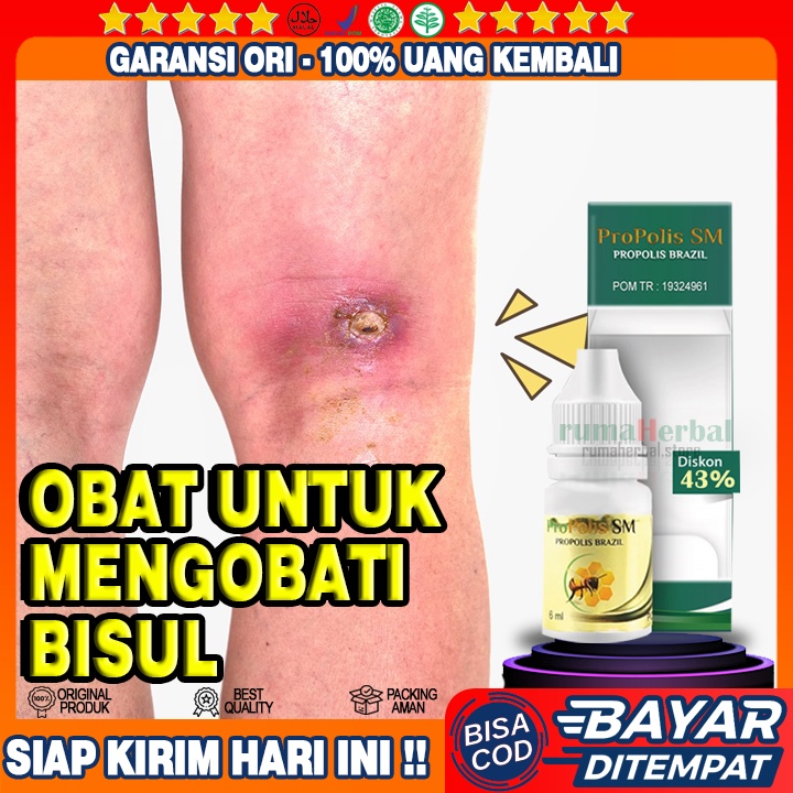 Obat Bisul, Penghilang Bisul Di Pantat, Bisul Kepala, Bisul Di Bawah Kelamin, Bisul Di Ketiak