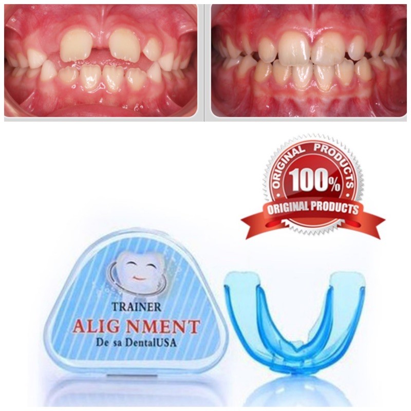 PERAPIH GIGI BEHELLDENTAL ORIGINAL / ALAT PELURUS TANPA BEHEL / TEETH TRAINER RETAINER ALIGNMENT 100% ORI ASLI - Dental Perata Gigi