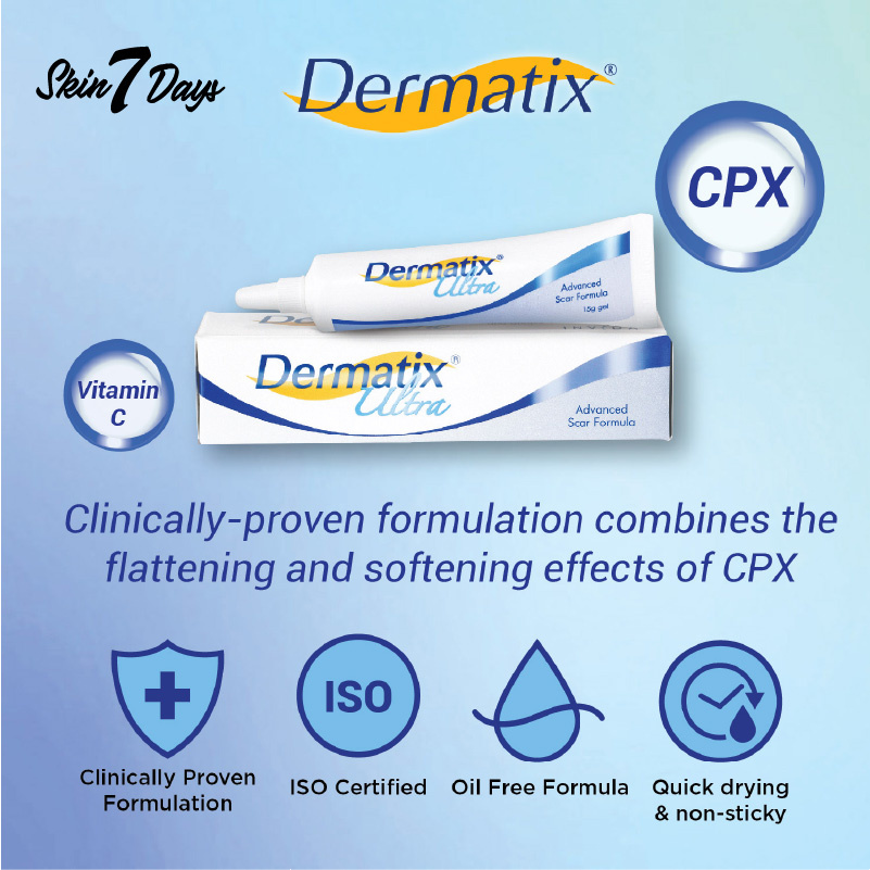 [ Dermatix Ultra ] Cream Penghilang Bekas Luka Operasi Iris Tergores Digigit Serangga Nyamuk / Luka Lama / Bakar / Gatal Hitam Koreng Di Kaki Oprasi Ampuh Advanced Scar Formula Gel Krim Wajah Keloid Stretchmark stretch mark Dermatik Dermatic Usa Original