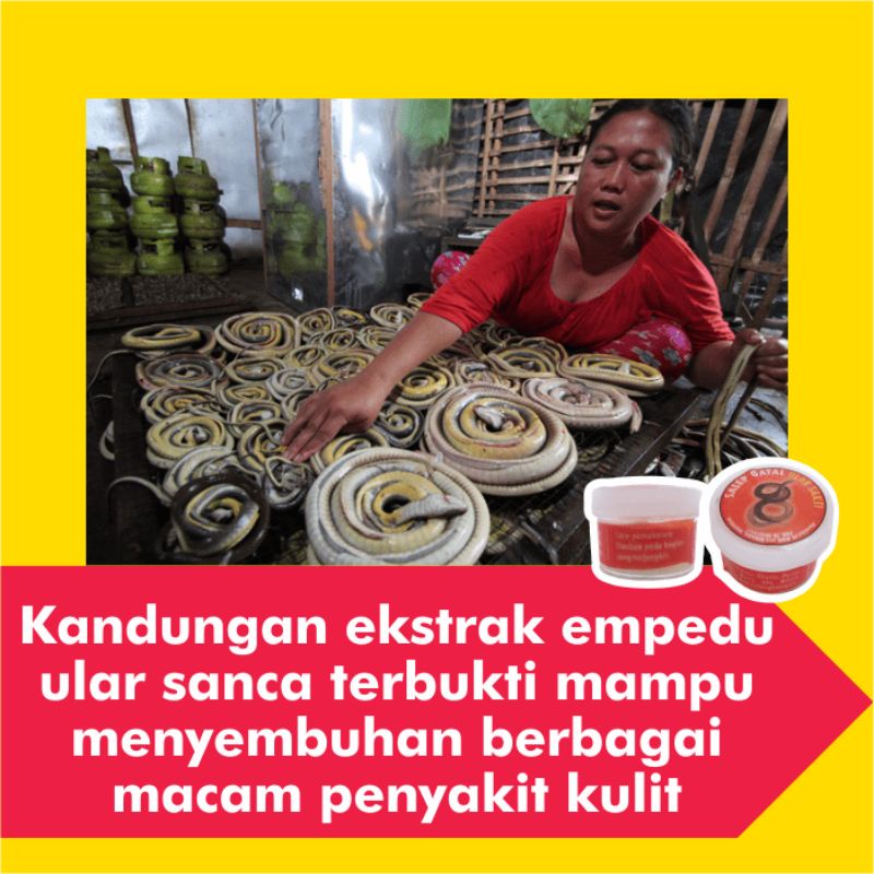 Salep Obat Kurap Kudis Paling Ampuh Gatal Eksim Kutu Air Jamur Kulit Selangkangan Gatel Jerawat Panu-6