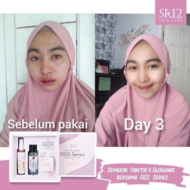 GLOW GLASS SKIN SERIES SR12 / SKINCARE PAKET GLOWING DALAM 7 HARI / KRIM PEMUTIH WAJAH / KRIM PENCERAH WAJAH / saudagarsr12