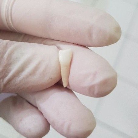 [SULUNG/SUSU] GIGI ASLI MANUSIA SERI / INCISIVUS SUSU / SULUNG / ANAK UNTUK PRAKTIKUM