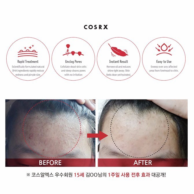 [BPOM] Cosrx - Acne Pimple Master Patch - 24pcs