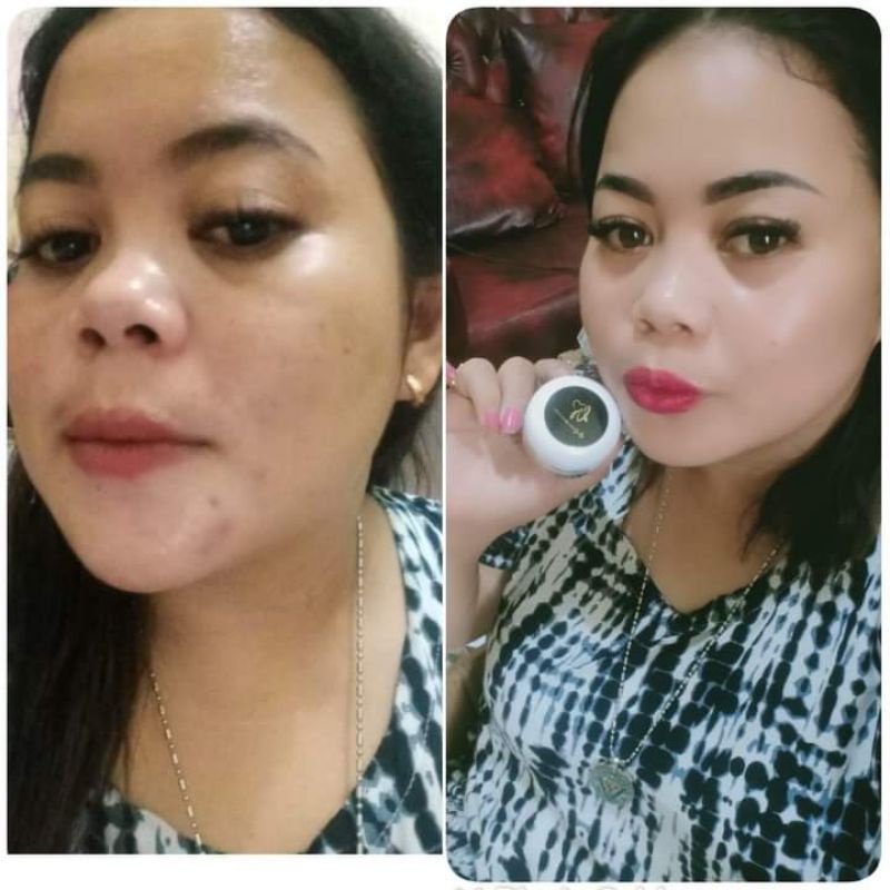 CREM DS DHIFIRA SKINCARE RDS