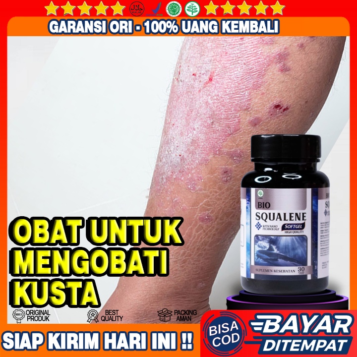 Obat Penyakit Kusta - Obat Kusta Basah & Kering Alami  - Obat Gatal Kusta - Obat Penyakit Lepra / Ku
