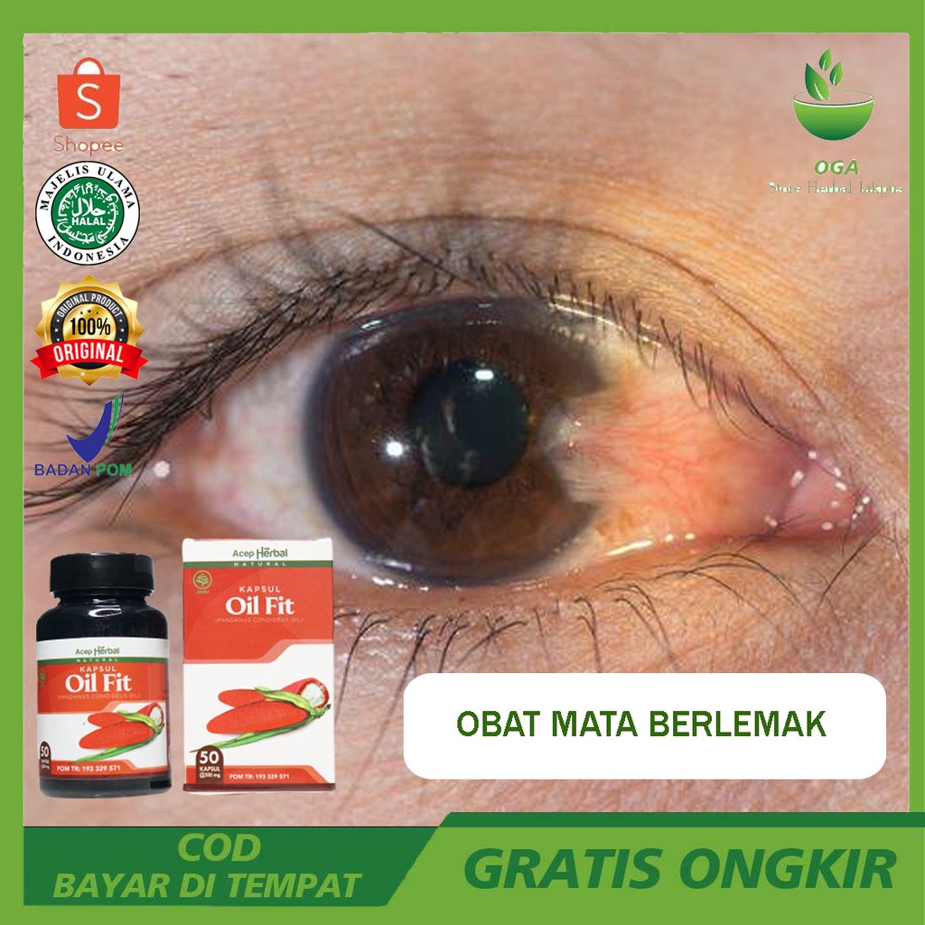 Jual Obat Mata Berlemak Merah Penglihatan Kurang Jelas Selaput Yang Menutupi Kornea Mata Dengan