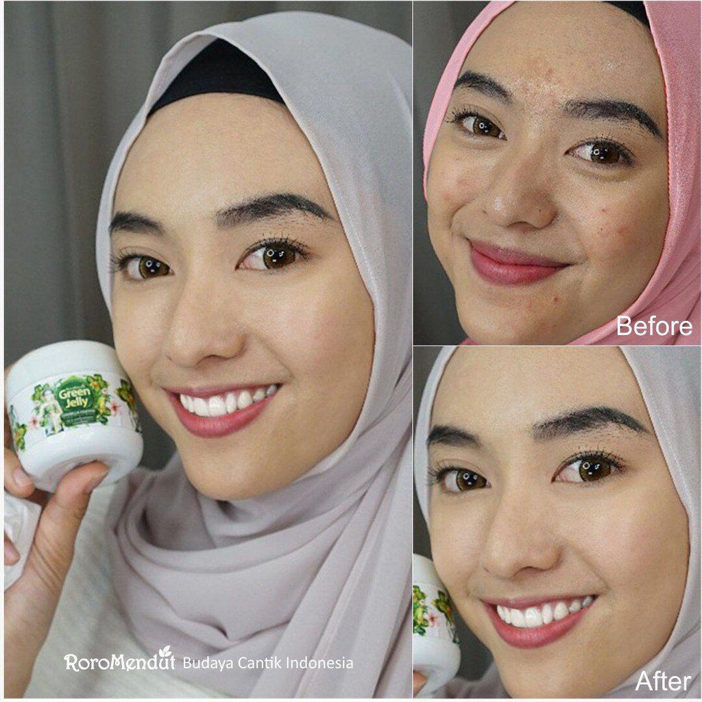 Roro Mendut Green Jelly Sleeping Mask Whitening + Anti Acne Jerawat 15 gr Super Glowing Premium