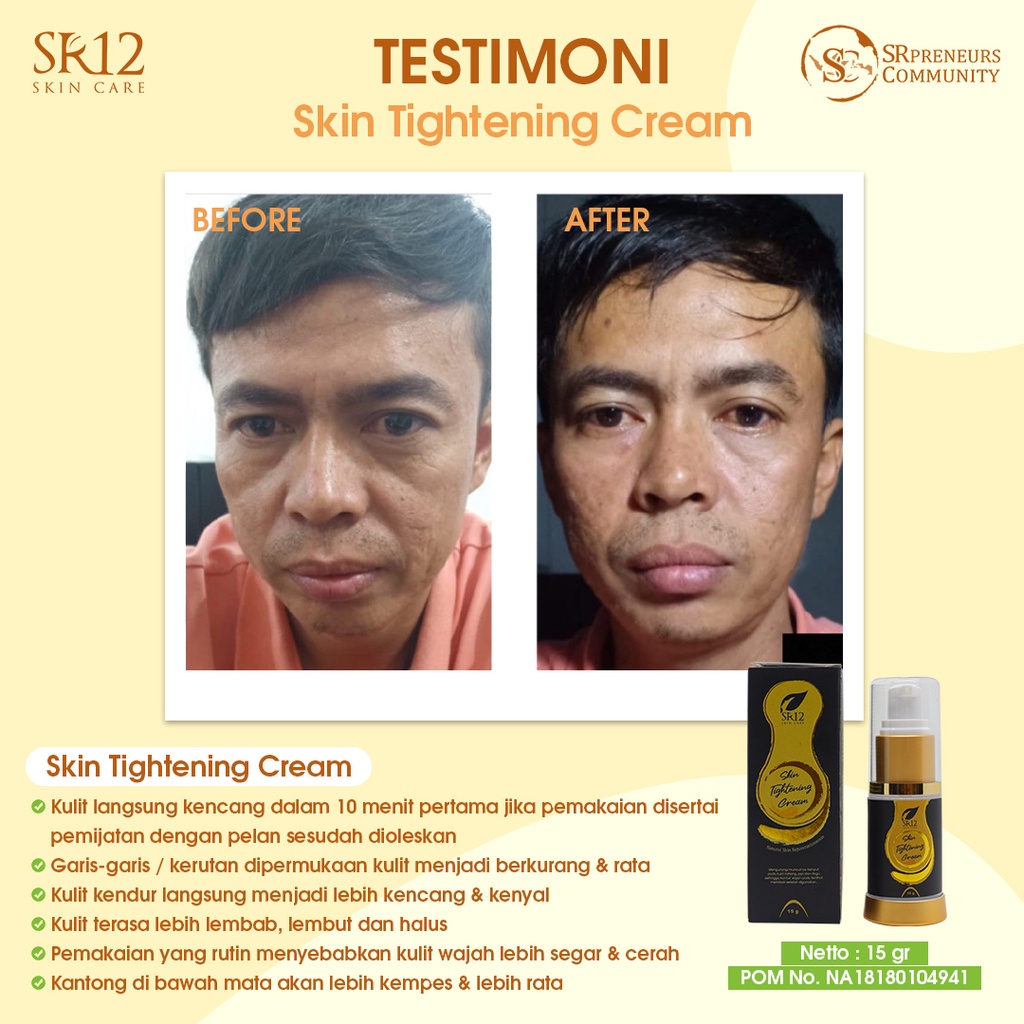 WHITENING TERBAIK!! PENCERAH WAJAH / PENGENCANG ANTI KERUT WAJAH / HERBAL TIGHTENING CREAM SR12