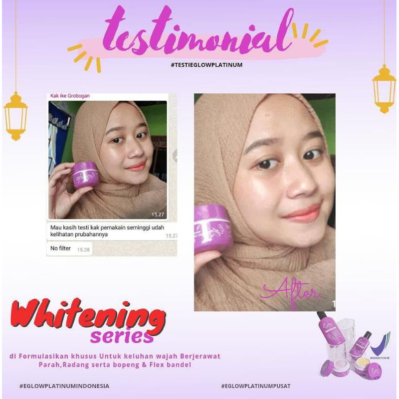ORIGINAL EGLOW PLATINUM SKINCARE PAKET GLOWING ACNE WHITENING ORIGINAL ASLI / BPOM SKINCARE MURAH HEMAT MEWAH / FREE GIFT HADIAH / SKINCARE TERLARIS AMAN BPOM HALAL PALING AMPUH UNTUK SEGALA KULIT WAJAH-2