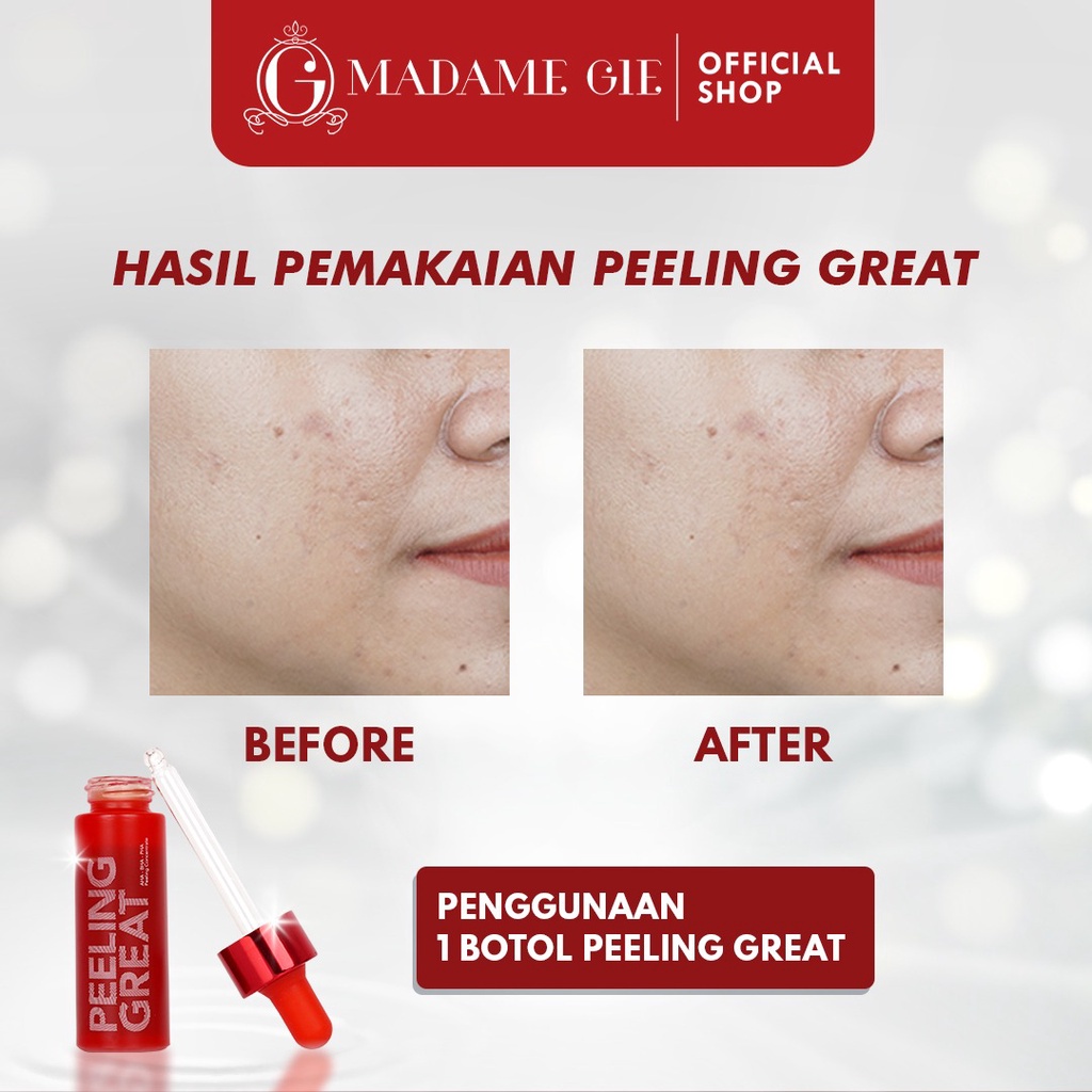 LIZBEAUTY - Madame Gie Peeling Great AHA-BHA-PHA - Peeling Concentrate