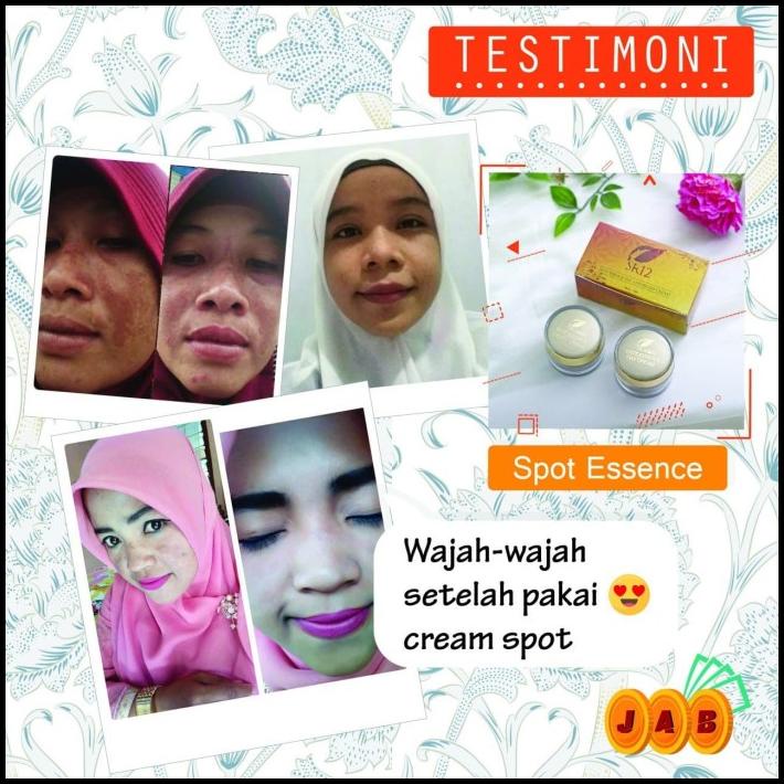 Spot Night Cream Wardah Olay Untuk Menghilangkan Flek Hitam Pada Wajah
