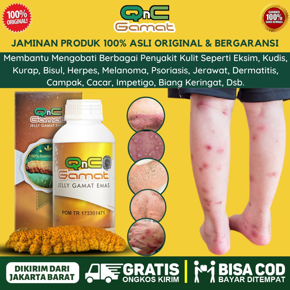 OBAT TRADISIONAL UNTUK SEMUA PENYAKIT KULIT EKSIM SCABIES HERPES ALERGI GATAL GATAL - OLES & MINUM