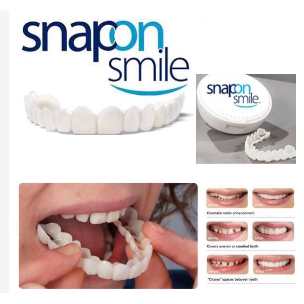 Snap On Smile 100% ORIGINAL Authentic Perawatan Kesehatan Gigi Palsu Renggang Snapon Smile 1 Set Sil