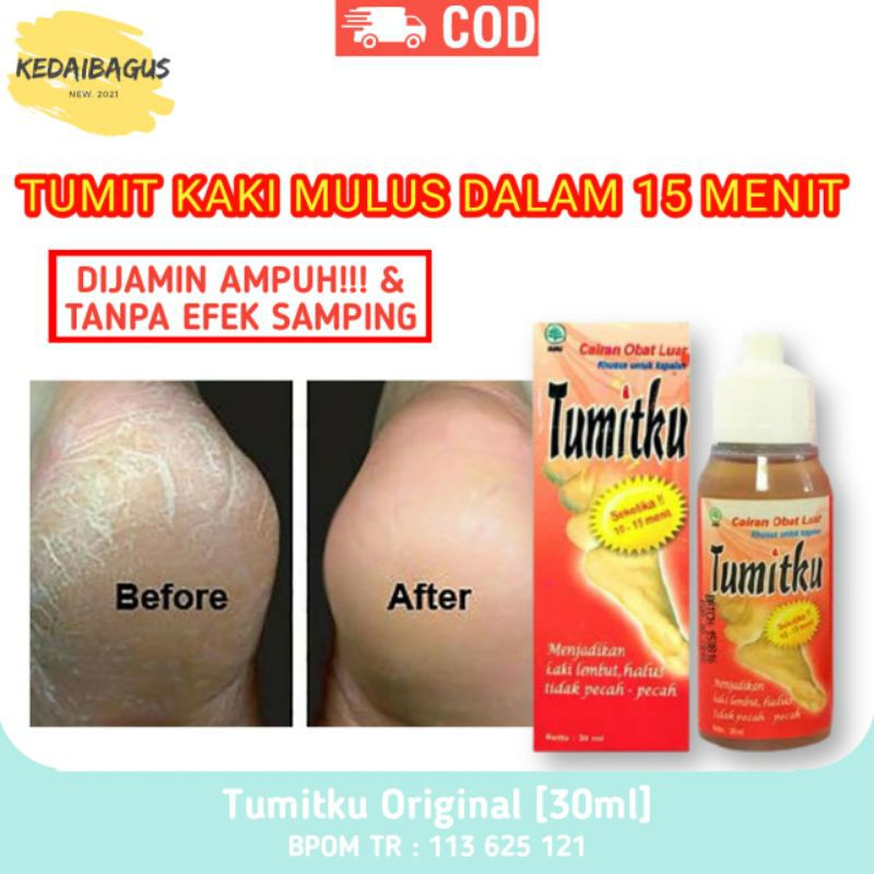 TUMITKU - Obat Tumit Kaki Pecah-pecah - Obat Tumit Pecah - Obat Telapak Kaki Pecah - Obat Kaki Kapal