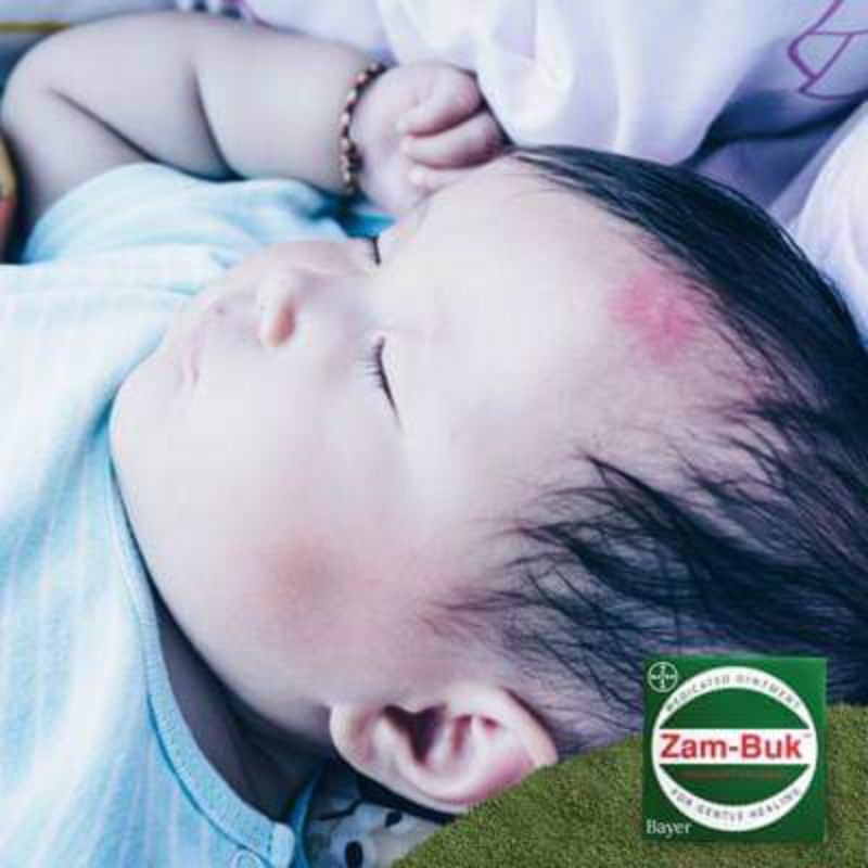 ZAMBUK ORIGINAL 100% TERSEDIA UKURAN BESAR DAN KECIL OBAT MEMAR DIGIGIT NYAMUK DAN SERANGGA