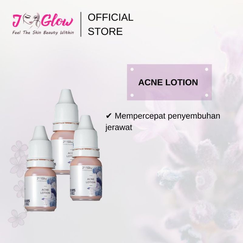 Jglow SULFUR /ACNE LOTION/SALEP TOTOL/SALEP SENSITIF