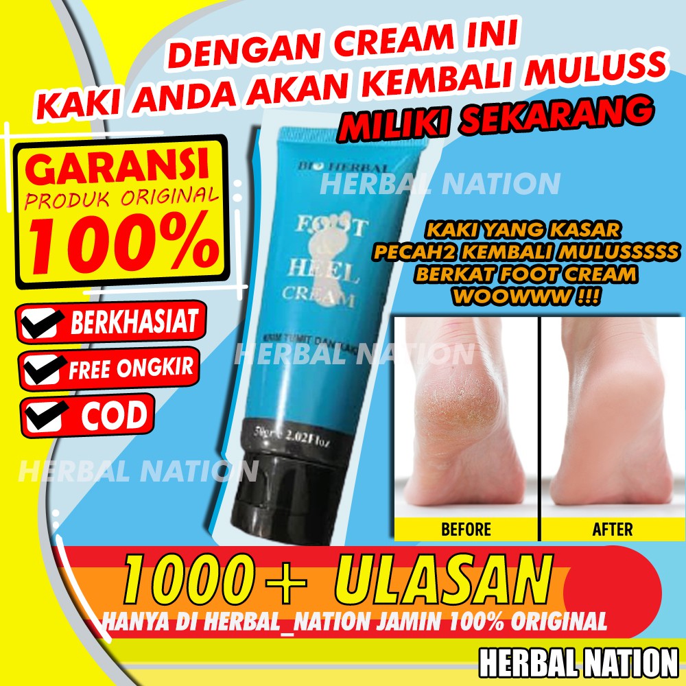 TERAMPUH!! Foot Cream Obat Kaki Pecah Dan Kering Obat Kaki Pecah2 Penghalus Tumit Kaki Ampuh