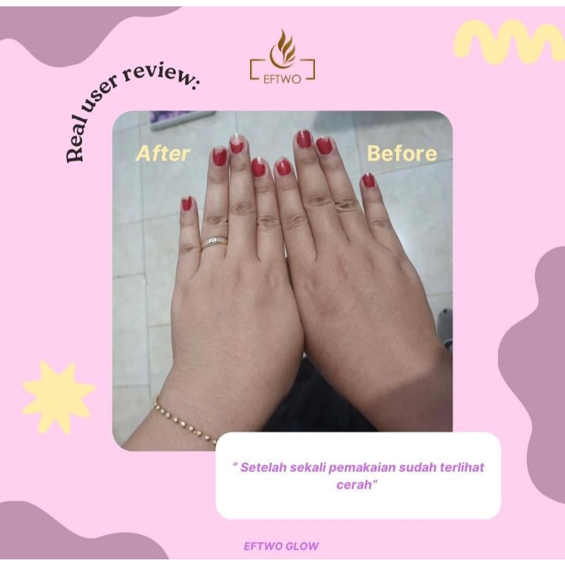 Eftwo Collagen Body Lotion / Body Lotion sultan /Pemutih instan Whitening/DNA salmon& Alpha Arbutin