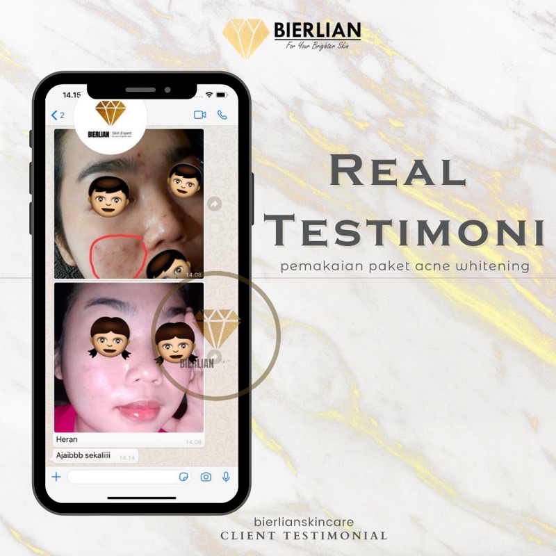BIERLIAN SKINCARE CREAM WAJAH WHITE GLOW/SUPER WHITE/ACNE/FLEK [Free Pouch+Gift]-7