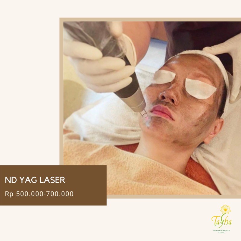 ND YAG LASER