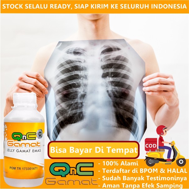 Jual Obat Flek Paru Pneumonia Radang Paru Infeksi Paru Emfisema Fibrosis Paru Cairan Di 0386