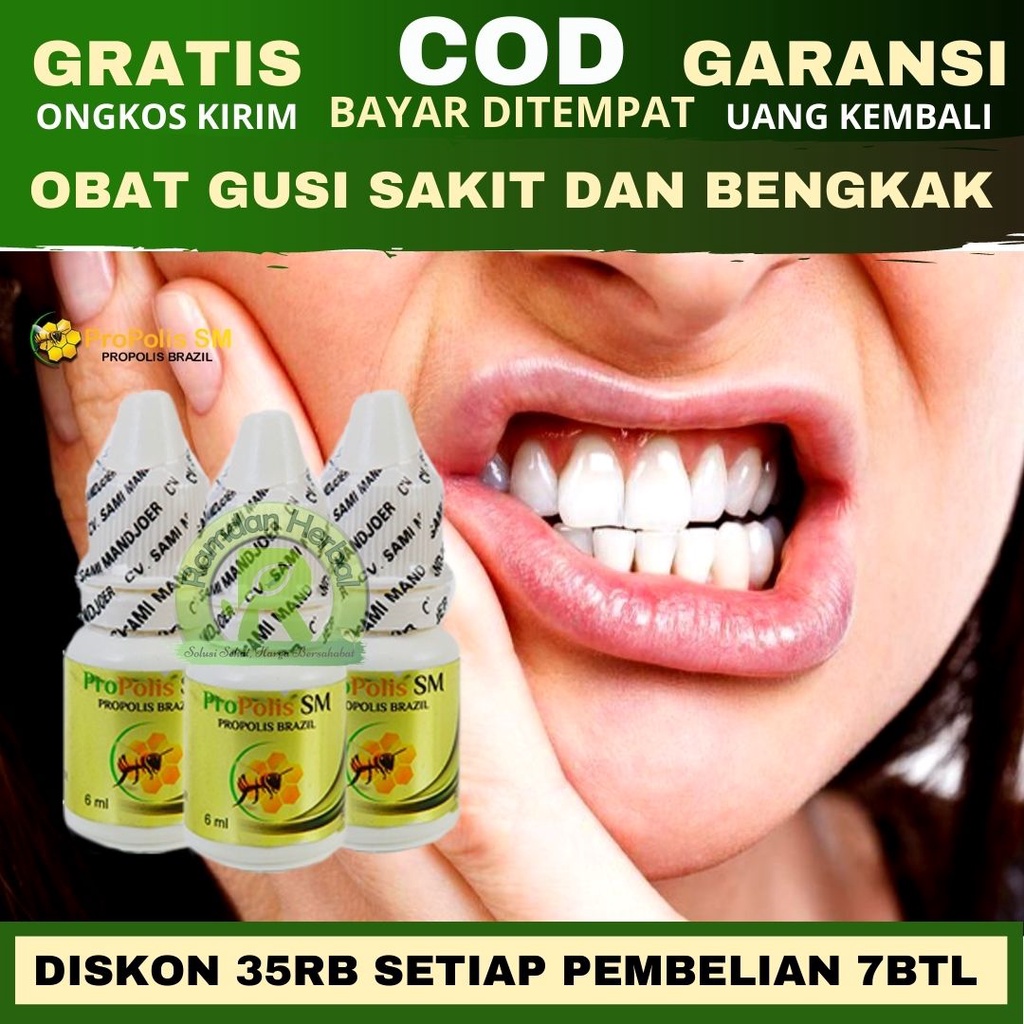 Obat Gusi Sakit Dan Bengkak - Gusi Bernanah - Gusi Berdarah - Infeksi Gusi - Propolis SM