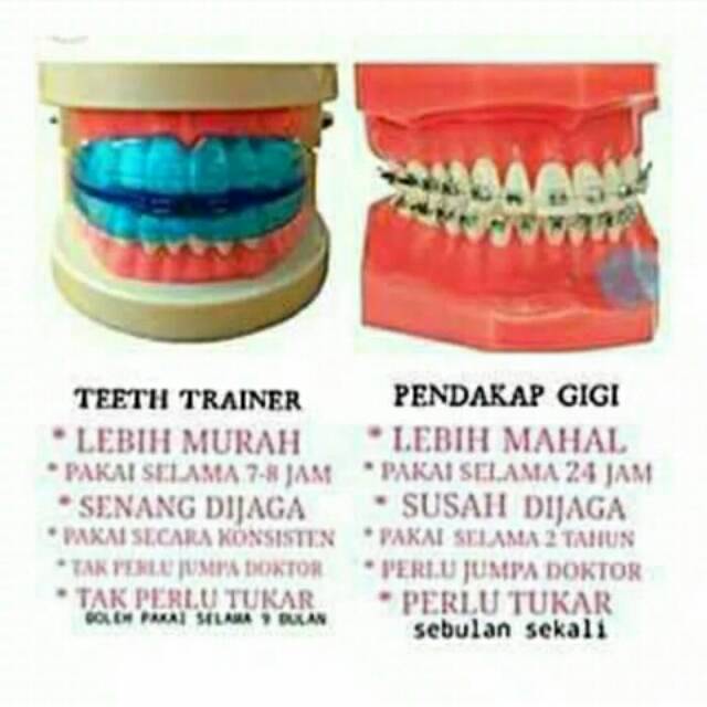 Perapih gigi teeth trainer alignment