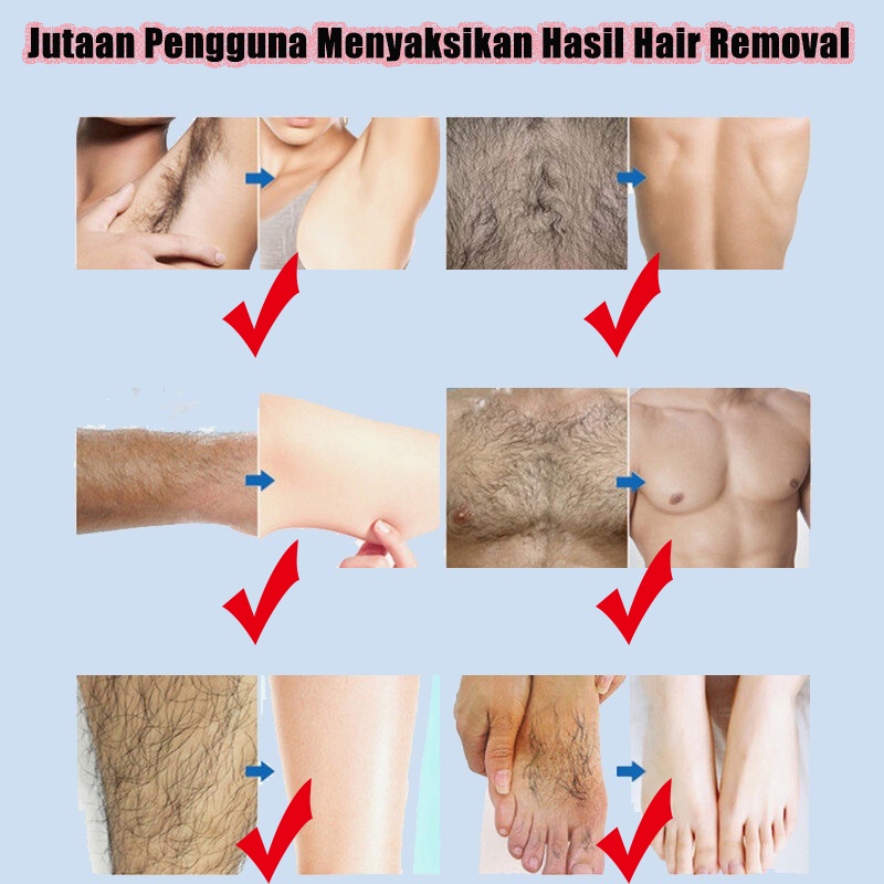 【Barang spot】Cream Penghilang Bulu Kaki Spray Penghilang Bulu Ketiak Krim Perontok Bulu Ketek/Pencabut Bbulu Kemaluan Wax Ketiak Kemaluan Removal Cream Alat Menghilangkan Bulu Vagina Semprot Krim Penghilang Rambut  Cream Hair Removal Depilatory Cream