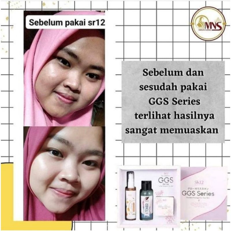 GGS SERIES GLOW GLASS SKIN SR12 HERBAL SKINCARE BPOM - KRIM GLOWING DALAM 1 MINGGU MENGHILANGKAN FLEK JERAWAT KRIM GLOWING KOREA PEMUTIH CEPAT ALAMI AMAN BPOM SKINCARE