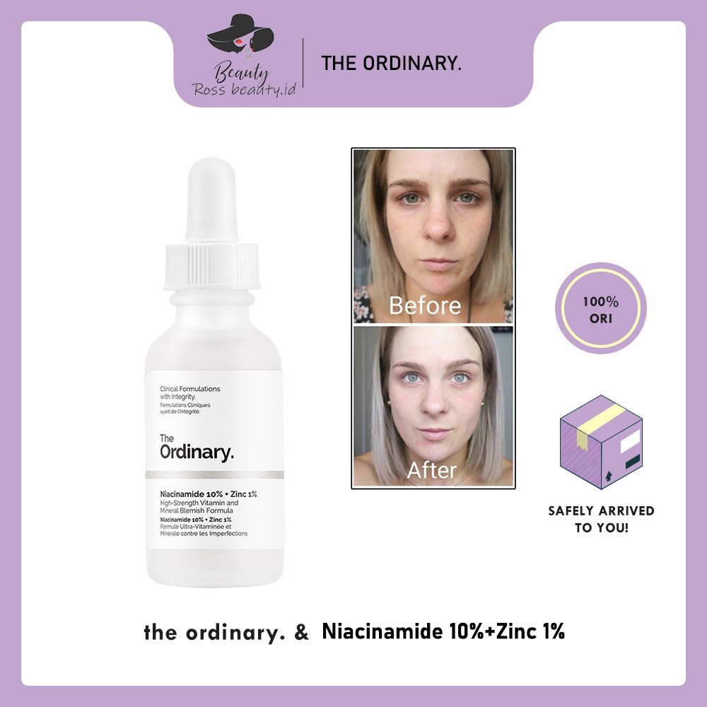 THE ORDINARY - Niacinamide 10% + Zinc 1% 30mL Acne Scars/ Bekas Jerawat