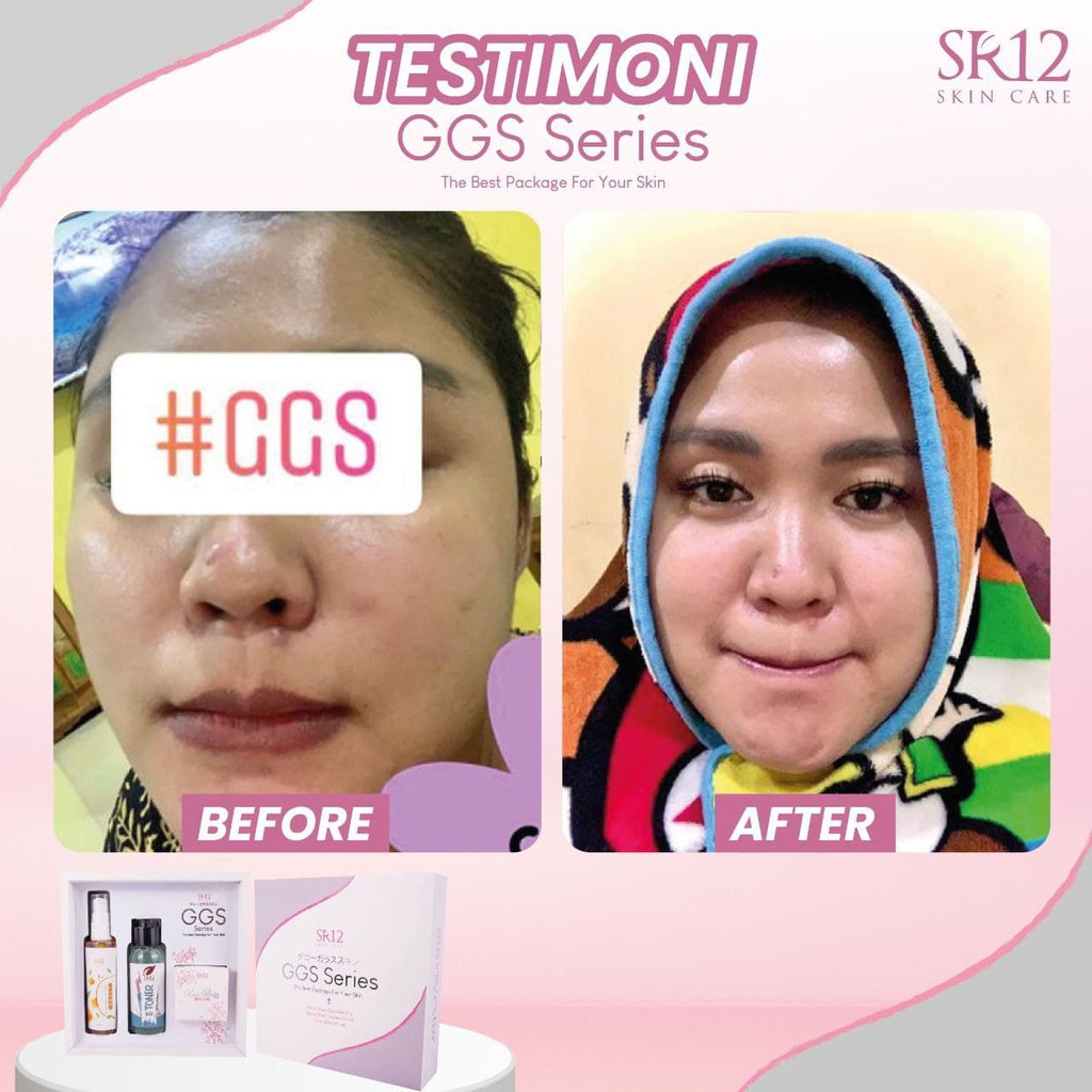 GGS Series SR12 Cream Glowing BPOM Ampuh Terlaris Pemutih Wajah Ori Dan Cepat Glow Glass Skin Gel