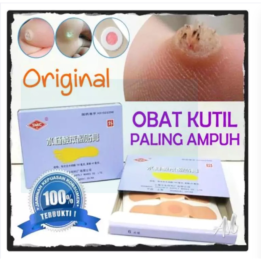 SD - Plester Obat Kutil &amp; Mata Ikan Penutup Kutil Koyo Kutil ji yan gao isi 6