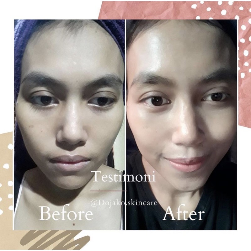 PAKET GLOWING WHITENING DOJAKO SKINCARE IMPORT READY