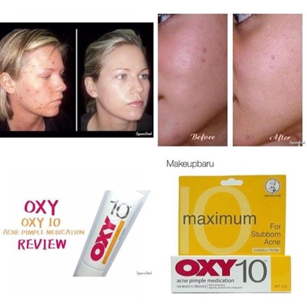 Oxy 10 Acne 10gr / 25gr / Obat Jerawat Oxy 10