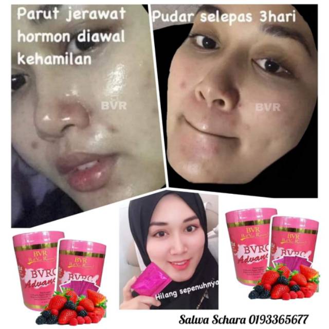 bvrc advan collagen pemutih original malaysia kemasan baru kotak