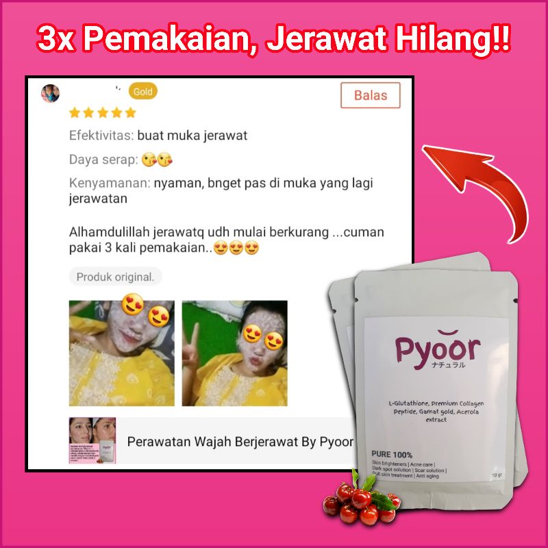 Masker Perawatan Wajah Berjerawat - Masker Wajah Jerawat - Masker Untuk Jerawat Dan Bruntusan Bekas 