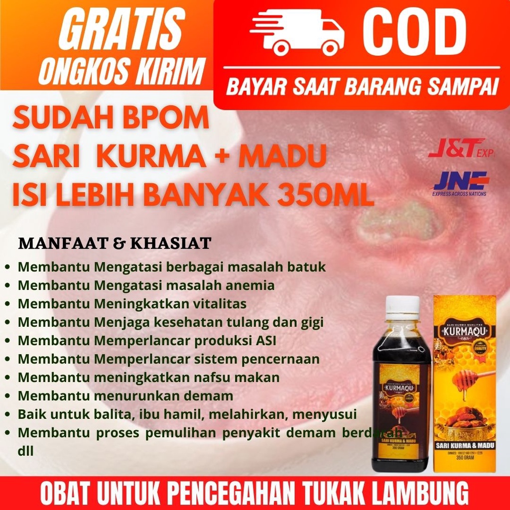 Obat Untuk Pencegahan Tukak Lambung-Luka Lambung-Infeksi Lambung-Nyeri Lambung-Sakit Lambung