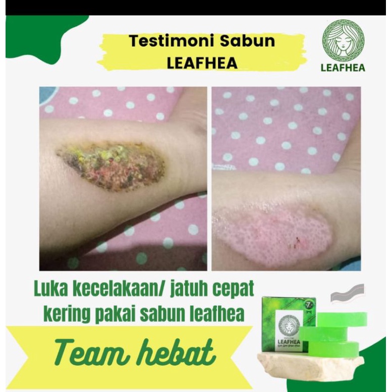 Sabun Leafhea Glutha Soap / Sabun Flek Wajah / Sabun Jerawat / Sabun gatal