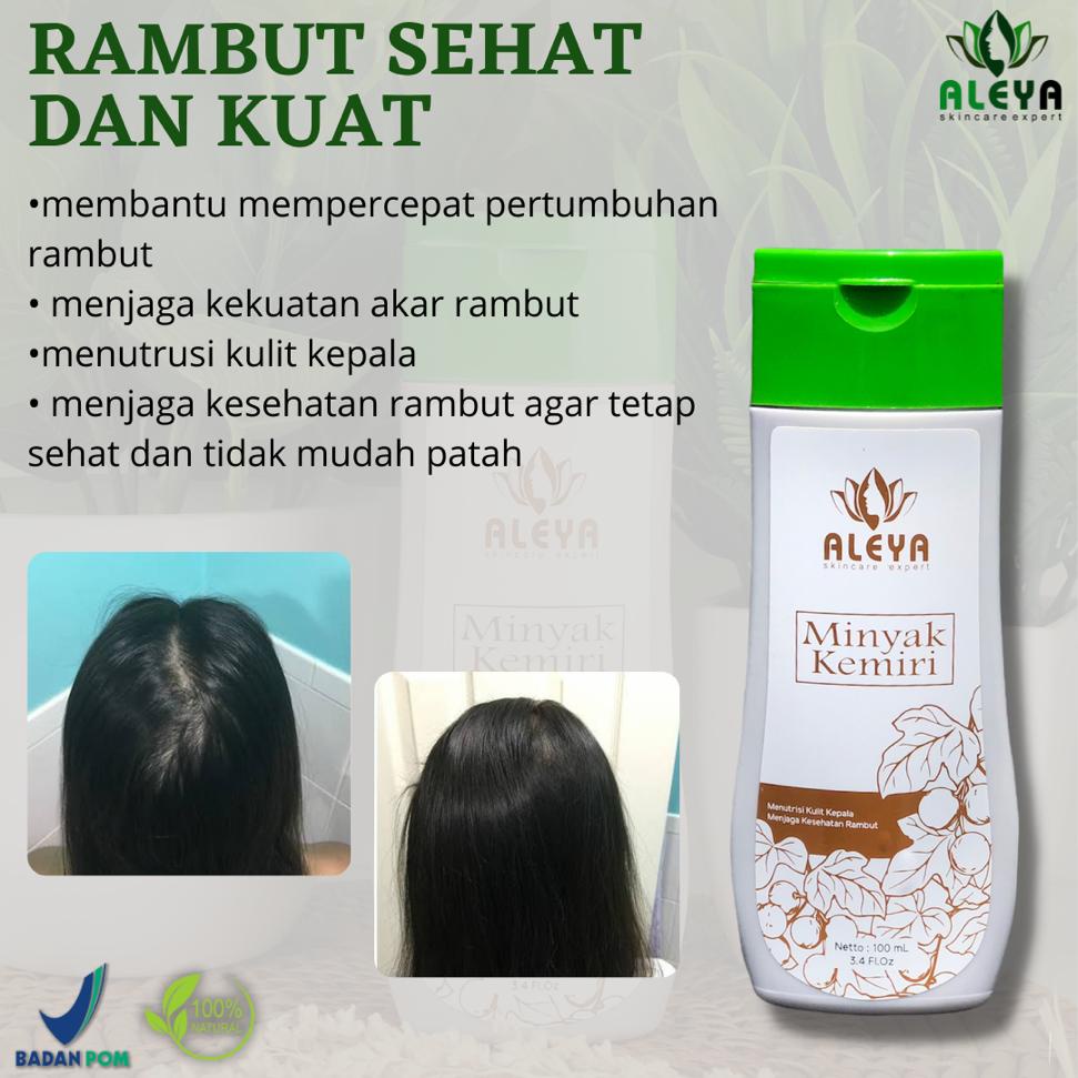 Minyak rambut minyak kemiri aleya penghilang ketombe