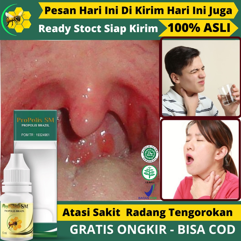 Jual Obat Sakit Tenggorokan Radang Tenggorokan Sakit Menelan