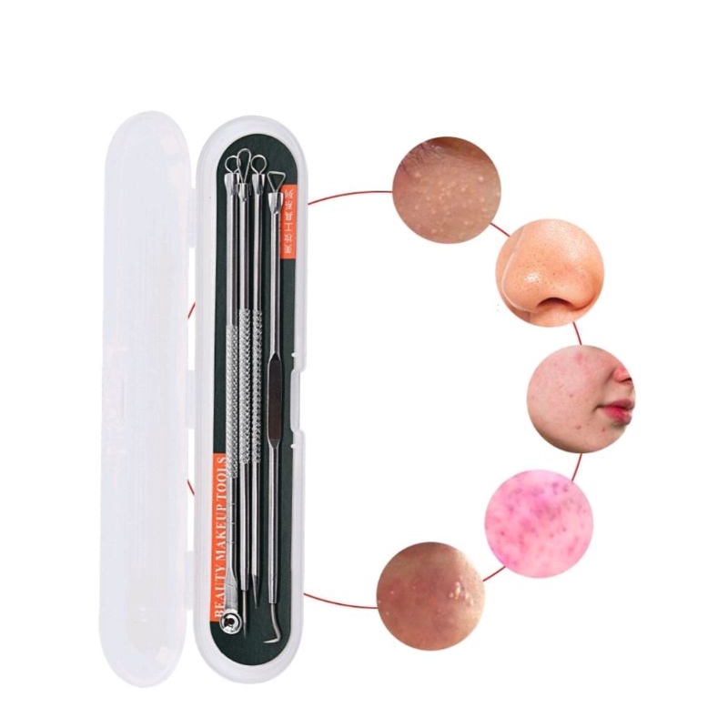 alat ekstraktor komedo isi 4 pcs / alat pencet komedo