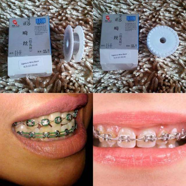 KAWAT LILIT BEHEL / DENTAL LIGATURE WIRE UNTUK RAPIHIN GIGI LEBIH CEPAT PER 1 METER BUKAN 1 ROLL