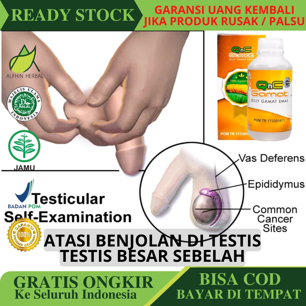 Jual Obat Pengempis Benjolan Di Testis Buah Zakar Testis Besar Sebelah Buah Zakar Bengkak 0665