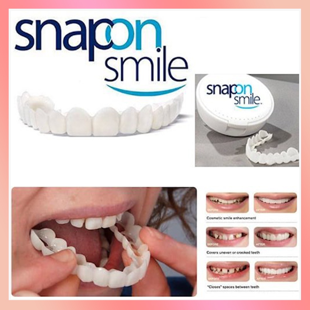 Snap On Smile Gigi Palsu 1 Set Atas Bawah - Gigi Palsu Silikon