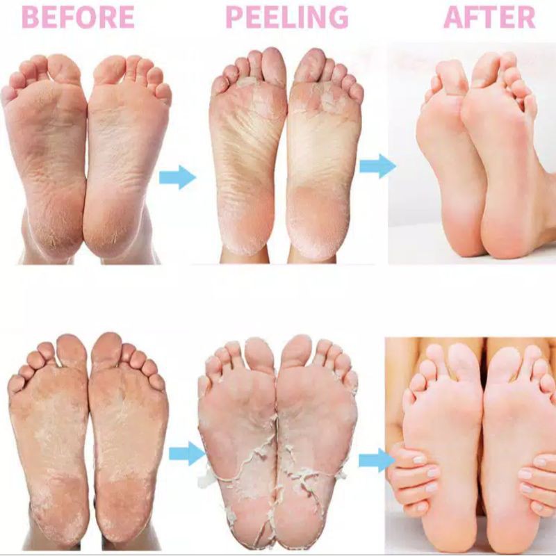 1 pasang Efero foot mask masker kaki foot peeling foot exfloating efero exfloating foot mask