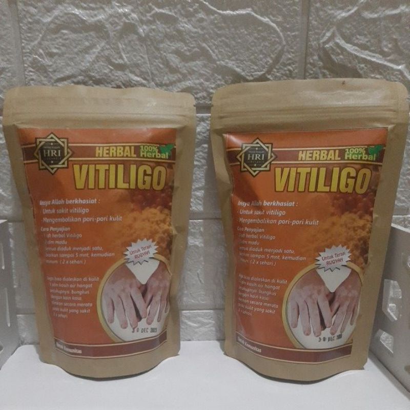 vitiligo herbal OBAT VITILIGO HERBAL ASLI MURNI ALAMI